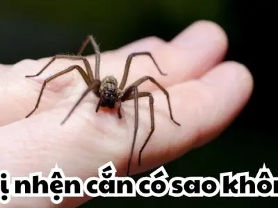 Bị nhện cắn có sao không khiến dân mạng hoang mang cực độ