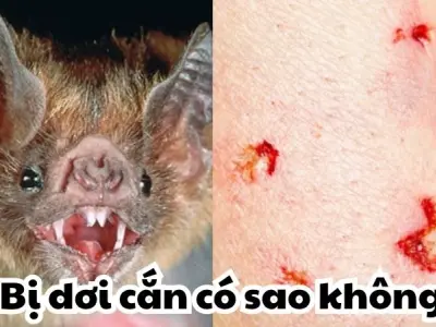Bị dơi cắn có sao không và cách xử lý nhanh chóng nhất