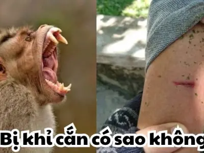Bị khỉ cắn có sao không và những điều không được bỏ qua