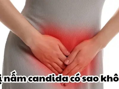 Bị nấm candida có sao không và cách điều trị hiệu quả