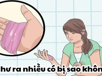 Khí hư ra nhiều có bị sao không? Những điều chị em cần biết