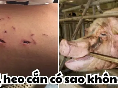 Giải mã bị heo cắn có sao không từ góc nhìn y khoa