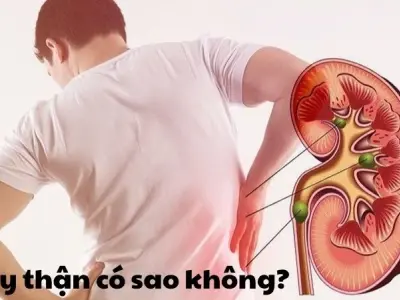 Bị suy thận có sao không và cách điều trị kịp thời