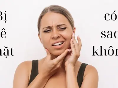 Bị tê mặt có sao không và những cảnh báo không ngờ