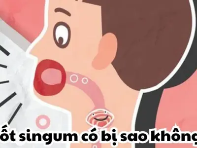 Nuốt singum có bị sao không và cách xử lý chuẩn khoa học