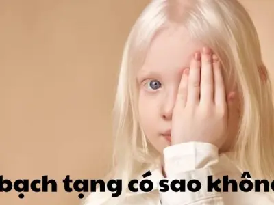 Bị bạch tạng có sao không và phương pháp cải thiện da
