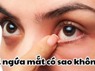 Bị ngứa mắt có sao không và dấu hiệu cảnh báo nguy hiểm