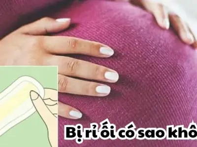 Bị rỉ ối có sao không và cách xử lý mẹ bầu cần biết