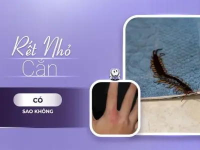 Rết nhỏ cắn có bị sao không và cách xử lý nhanh chóng