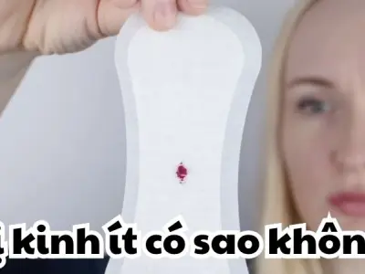 Bị kinh ít có sao không và những dấu hiệu đáng cảnh báo