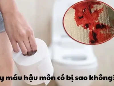 Chảy máu hậu môn có bị sao không và có nguy hiểm không