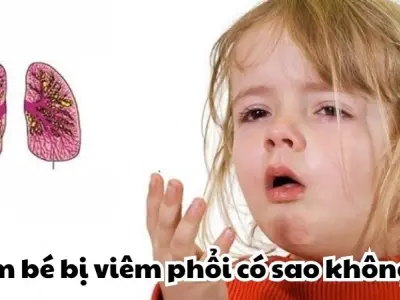 Em bé bị viêm phổi có sao không và cách nhận biết sớm