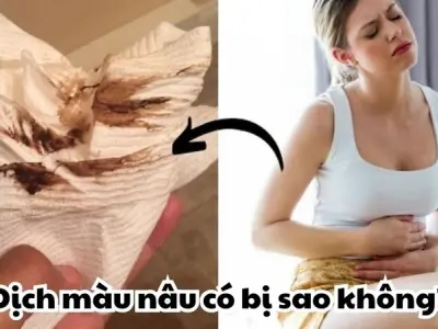 Dịch màu nâu có bị sao không và cách xử lý tại nhà