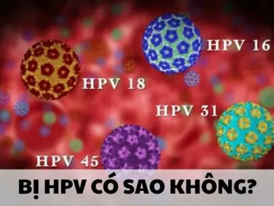 Bị HPV có sao không và những hệ lụy bạn không ngờ đến