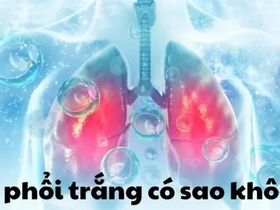 Bị phổi trắng có sao không và mức độ nguy hiểm thực sự