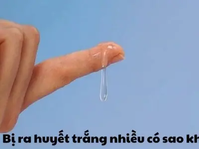 Bị ra huyết trắng nhiều có sao không và cảnh báo đang lo