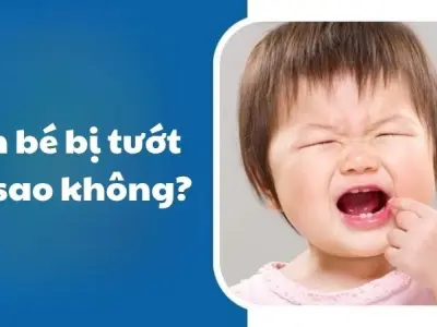 Em bé bị tướt có sao không khi trẻ bước vào tuổi mọc răng