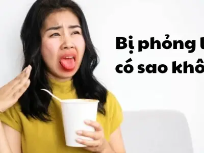 Bị phỏng lưỡi có sao không và nên làm gì để dịu nhanh