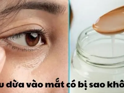 Dầu dừa vào mắt có bị sao không và cách xử lý đúng