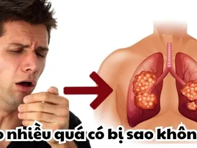 Ho nhiều quá có bị sao không và khi nào cần đi khám