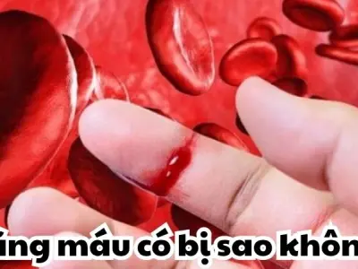 Loãng máu có bị sao không và phương pháp điều trị an toàn