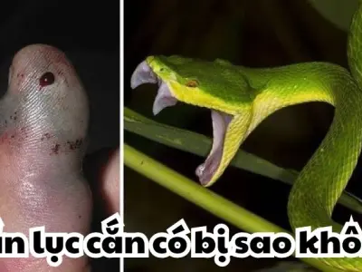Rắn lục cắn có bị sao không - Có nguy hiểm đến tính mạng