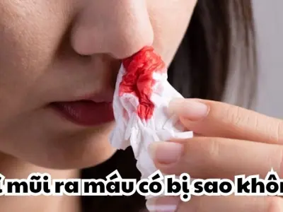 Xì mũi ra máu có bị sao không và nguy hiểm thế nào