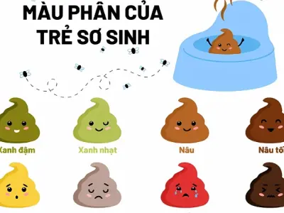 Cách phân biệt phân của trẻ sơ sinh chi tiết dễ hiểu