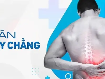 Giãn dây chằng và các mẹo chữa trị hiệu quả từ dân gian