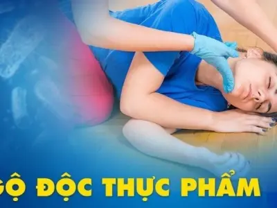 Hướng dẫn mẹo dân gian chữa ngộ độc thức ăn tại nhà