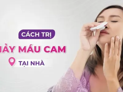 Bật mí mẹo dân gian trị chảy máu cam đơn giản dễ thực hiện