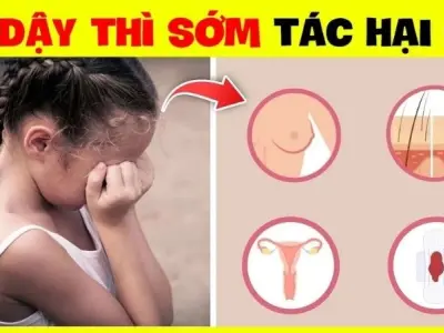 Đằng sau dậy thì sớm là loạt tác hại ảnh hưởng lâu dài
