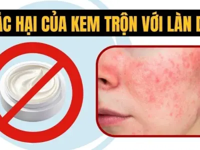 Sốc với tác hại dùng kem trộn âm thầm hủy hoại làn da