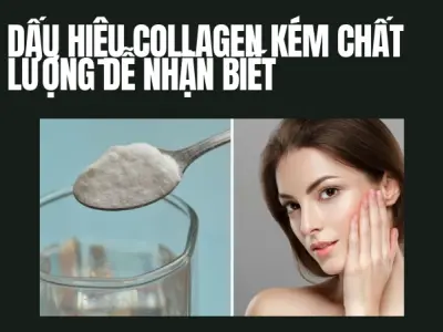 Kinh nghiệm nhận biết collagen kém chất lượng chuẩn xác