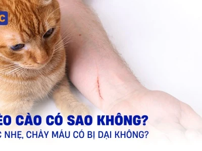 Bị mèo cào có sao không và cách xử lý vết thương đúng cách