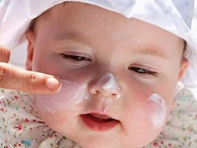 Mẹo Chữa Chàm Sữa Ở Trẻ Sơ Sinh Hiệu Quả Theo Dân Gian Và Khoa Học