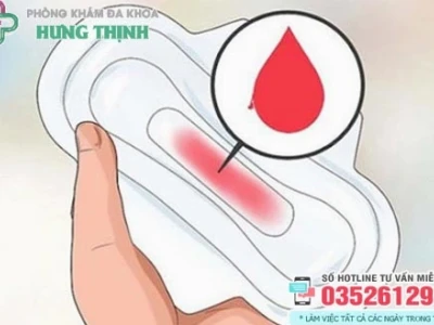Mẹo Chữa Kinh Nguyệt Ra Nhiều Tại Nhà Hiệu Quả