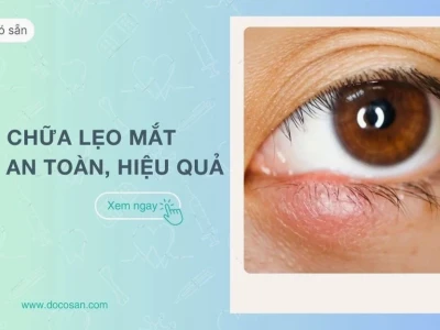 Mẹo Chữa Mụt Lẹo Mắt Hiệu Quả Nhanh Chóng Tại Nhà Năm 2026