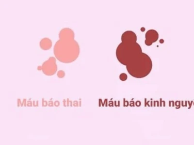 Phân biệt máu báo thai và máu kinh nguyệt: Dấu hiệu nhận biết và thời điểm