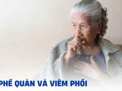 Phân biệt viêm phế quản và viêm phổi: Dấu hiệu nhận biết và cách điều trị